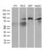 Forkhead Box O1 antibody, LS-C795580, Lifespan Biosciences, Western Blot image 