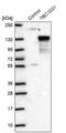 TBC1 Domain Family Member 31 antibody, PA5-54869, Invitrogen Antibodies, Western Blot image 