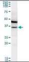 Malate Dehydrogenase 1 antibody, orb95241, Biorbyt, Western Blot image 