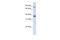 Tubulin Polyglutamylase Complex Subunit 2 antibody, A15764, Boster Biological Technology, Western Blot image 