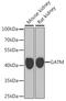 Glycine amidinotransferase, mitochondrial antibody, A02754, Boster Biological Technology, Western Blot image 