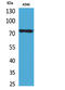 Tumor Protein P73 antibody, STJ96709, St John