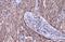 Serpin Family B Member 3 antibody, GTX114739, GeneTex, Immunohistochemistry paraffin image 