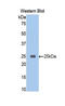 Carboxypeptidase B2 antibody, LS-C297225, Lifespan Biosciences, Western Blot image 
