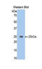 TAFI antibody, LS-C297225, Lifespan Biosciences, Western Blot image 