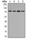 Solute Carrier Family 22 Member 11 antibody, orb341365, Biorbyt, Western Blot image 