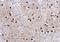 Glutathione S-Transferase Pi 1 antibody, NBP2-16756, Novus Biologicals, Immunohistochemistry frozen image 