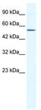 Zinc Finger Protein 286A antibody, TA339516, Origene, Western Blot image 