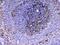 Vascular Cell Adhesion Molecule 1 antibody, PA5-80213, Invitrogen Antibodies, Immunohistochemistry frozen image 