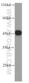 Chromaffin granule amine transporter antibody, 22016-1-AP, Proteintech Group, Western Blot image 