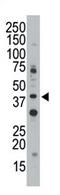 CD33 Molecule antibody, AP11624PU-N, Origene, Western Blot image 