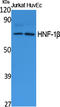 HNF1 Homeobox B antibody, STJ96448, St John