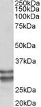 Kruppel Like Factor 13 antibody, TA311452, Origene, Western Blot image 