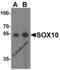 SRY-Box 10 antibody, 8481, ProSci, Western Blot image 