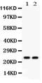 Lipocalin 2 antibody, PA5-79589, Invitrogen Antibodies, Western Blot image 