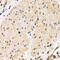 Transmembrane protease serine 2 antibody, 18-426, ProSci, Immunohistochemistry frozen image 