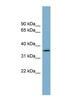 Acyl-CoA Wax Alcohol Acyltransferase 1 antibody, NBP1-59866, Novus Biologicals, Western Blot image 