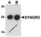 Synaptogyrin 3 antibody, 5567, ProSci, Western Blot image 