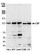 RB Binding Protein 8, Endonuclease antibody, A300-488A, Bethyl Labs, Western Blot image 