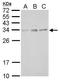 Solute Carrier Family 25 Member 27 antibody, GTX128022, GeneTex, Western Blot image 