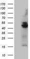 Glycerol-3-Phosphate Acyltransferase 3 antibody, LS-C795137, Lifespan Biosciences, Western Blot image 