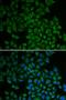 Serum/Glucocorticoid Regulated Kinase 1 antibody, orb129741, Biorbyt, Immunocytochemistry image 