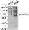 Serpin Family A Member 3 antibody, MBS2528799, MyBioSource, Western Blot image 