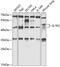 Interleukin 1 Receptor Type 2 antibody, 15-356, ProSci, Western Blot image 