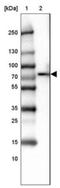 Lymphocyte Cytosolic Protein 2 antibody, NBP1-87033, Novus Biologicals, Western Blot image 