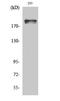 WNK1 antibody, STJ90776, St John