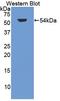 Glycogen Synthase Kinase 3 Alpha antibody, MBS2013023, MyBioSource, Western Blot image 