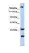 Protein dispatched homolog 1 antibody, NBP1-59442, Novus Biologicals, Western Blot image 