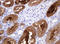 Gamma-Butyrobetaine Hydroxylase 1 antibody, LS-C337967, Lifespan Biosciences, Immunohistochemistry paraffin image 