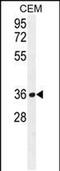 Nudix Hydrolase 22 antibody, PA5-48158, Invitrogen Antibodies, Western Blot image 