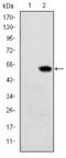 Retinol Binding Protein 4 antibody, STJ98356, St John