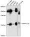 Microtubule Associated Protein 1 Light Chain 3 Gamma antibody, GTX66514, GeneTex, Western Blot image 
