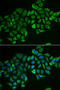 Ras Homolog Family Member D antibody, STJ28546, St John