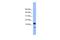 Cell Division Cycle 26 antibody, A09821, Boster Biological Technology, Western Blot image 