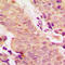 Signal Transducer And Activator Of Transcription 5A antibody, LS-C354261, Lifespan Biosciences, Immunohistochemistry paraffin image 