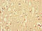 Myosin Heavy Chain 3 antibody, LS-C678722, Lifespan Biosciences, Immunohistochemistry paraffin image 