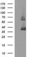 Secretory Carrier Membrane Protein 2 antibody, CF506972, Origene, Western Blot image 
