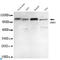 Ubiquitin Like With PHD And Ring Finger Domains 1 antibody, LS-C813150, Lifespan Biosciences, Western Blot image 