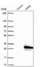 NME/NM23 Family Member 5 antibody, NBP1-92188, Novus Biologicals, Western Blot image 
