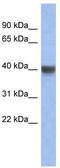 Immediate-early protein CL-6 antibody, TA345657, Origene, Western Blot image 
