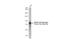 Alkaline Phosphatase, Biomineralization Associated antibody, GTX100817, GeneTex, Western Blot image 