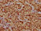 Histone Cluster 1 H1 Family Member C antibody, LS-C676859, Lifespan Biosciences, Immunohistochemistry paraffin image 