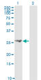 Fibroblast Growth Factor 21 antibody, LS-C133715, Lifespan Biosciences, Western Blot image 