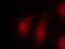 Ribosomal Protein S6 Kinase A1 antibody, GTX50169, GeneTex, Immunofluorescence image 