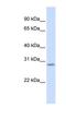 Scratch Family Transcriptional Repressor 2 antibody, NBP1-79405, Novus Biologicals, Western Blot image 