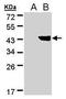 Trans-1,2-dihydrobenzene-1,2-diol dehydrogenase antibody, PA5-28001, Invitrogen Antibodies, Western Blot image 